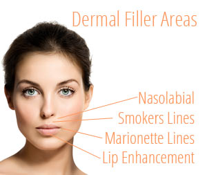 Dermal Fillers Cheshire
