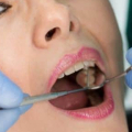 Limited-Time Offer: Private Emergency Dental Examination – Only £95!