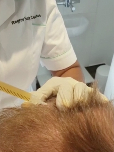 Main photo for Regrow Hair Centre Ltd